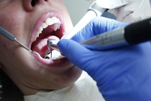 Zobozdravniki: Prenova endodontskih storitev prinaša manj dostopno zobozdravstvo