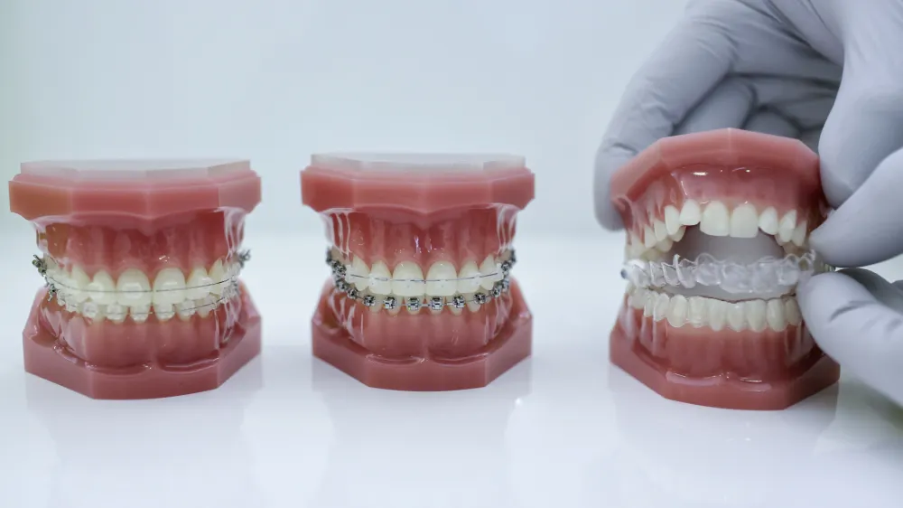 - simbolična fotografija - stomatologija - dentalna medicina - estetsko zobozdravstvo - ortodontija - ortodontski aparat za ravnanje zob - zobna proteza - zobotehnik - <br><br><br><br> //FOTO: Jaka Gasar