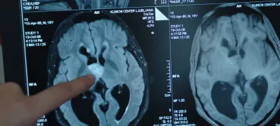aparat za slikanje z magnetno resonanco magnetom trio (3T), - Klinični center Ljubljana (KC) - Klinični inštitut za radiologijo – tumor v možganih <br><br><br>,//FOTO: Matej PovšeOPOMBA: ZA OBJAVO V ČASOPISU DNEVNIK