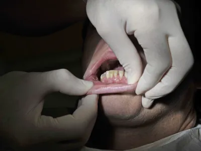 - ilustrativna fotografija- zobozdravnik, zobozdravstvo, bolezni zob in dlesni    //FOTO: Tomaž Zajel&scaron;nik