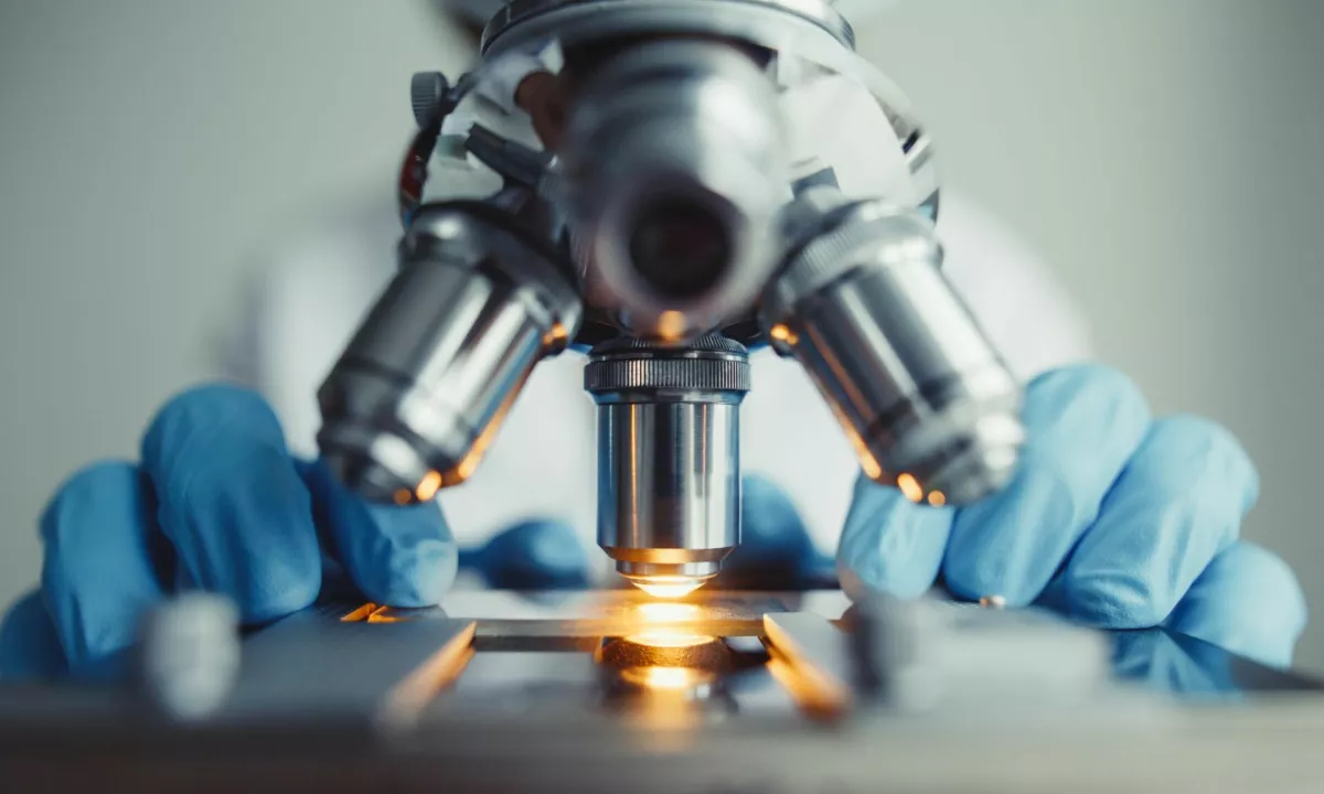 Slovenski raziskovalci odkrili nov biološki proces za uravnavanje beljakovin v celicah