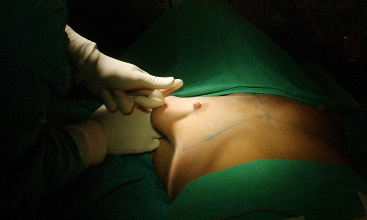 (PRENOS) Preiskali nezakonite estetske posege v Mariboru