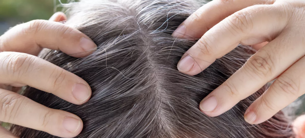 Aging with grace and confidence, brown-haired woman with long brown hair with gray hair, female forehead close-up, hands hold strands of hair, Hair care and grooming for mature women / Foto: Victor Golmer