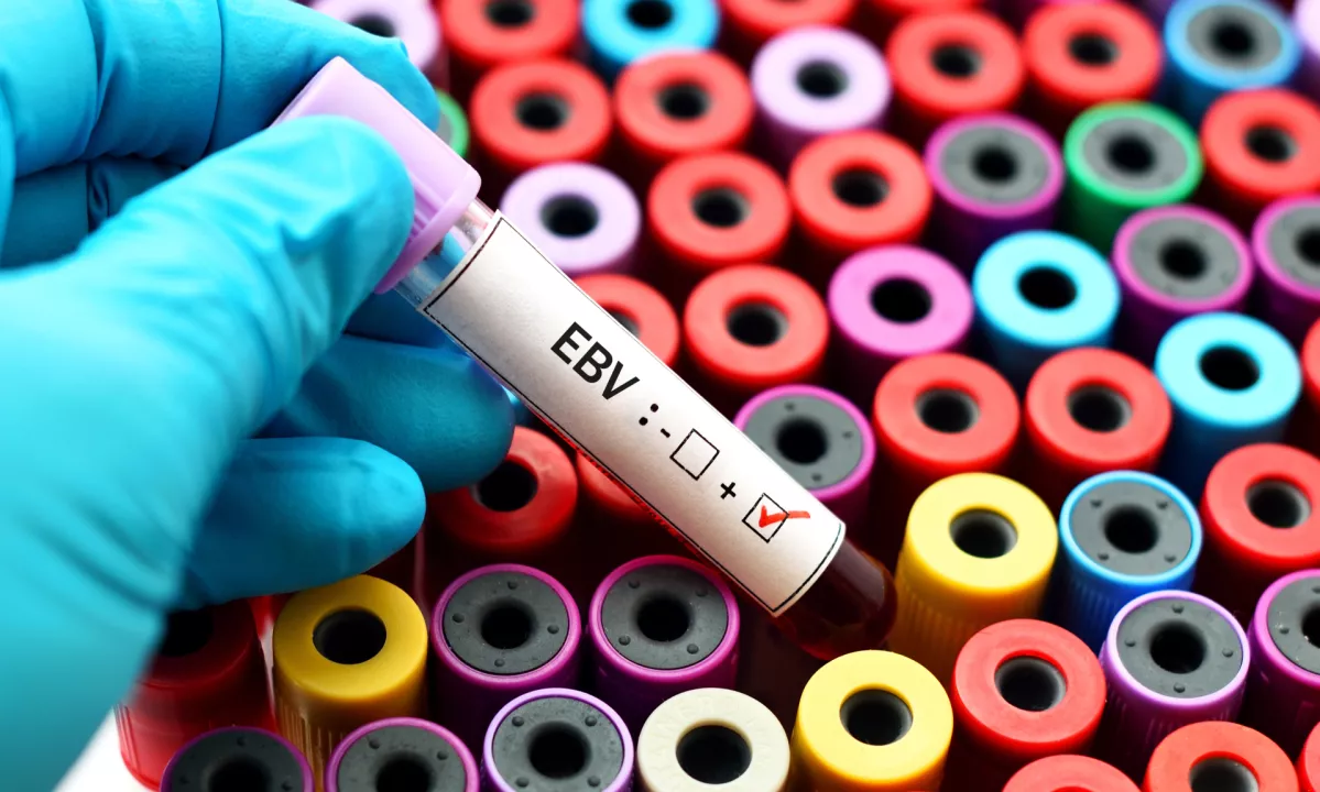 Zakaj skrivnostni Epstein-Barrov virus pri nekaterih povzroči hude bolezni, pri večini pa ne?