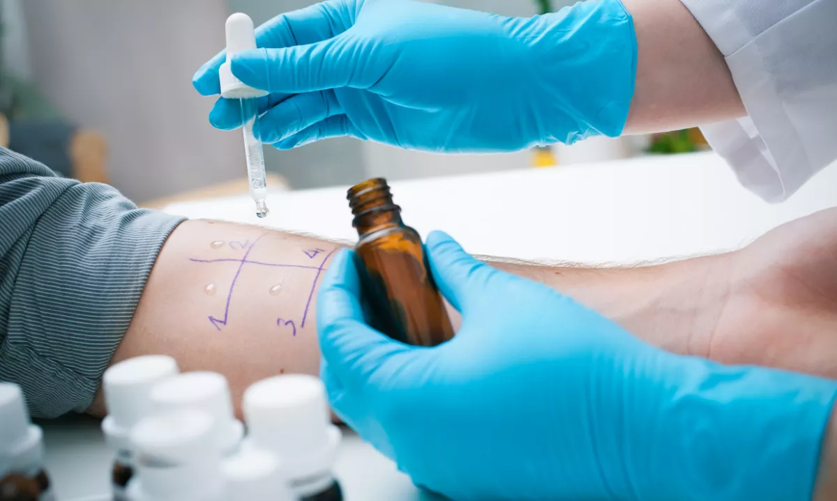 Domnevna alergija na penicilin je ena najpogostejših oznak v zdravstveni dokumentaciji in hkrati ena najpogosteje napačnih.