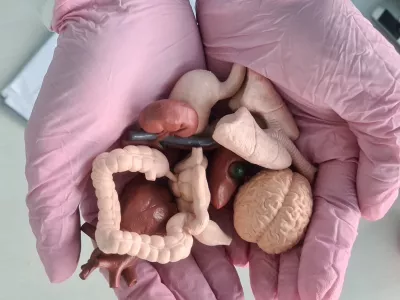 Gastroenterologist holds in hands models of organs for examination. Medical insurance, healthcare and internal organs / Foto: Nadzeya Haroshka Getty Images