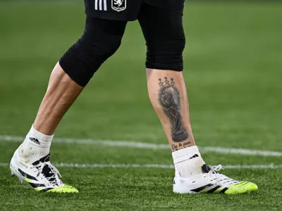 Soccer Football - UEFA Europa League - Quarter Final - First Leg - Bologna v Aston Villa - Stadio Renato Dall'Ara, Bologna, Italy - April 9, 2026 A tattoo of the world cup trophy on the leg of Aston Villa's Emiliano Martinez is seen during the warm up before the match REUTERS/Jennifer Lorenzini