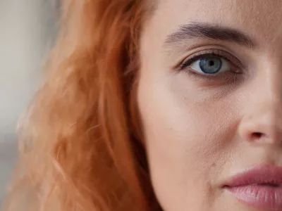 Bela polt je ena od prilagoditev evolucije. / Foto: Istock