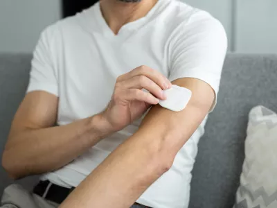 Obliž je potrebno zamenjati dvakrat na teden. / Foto: Istock