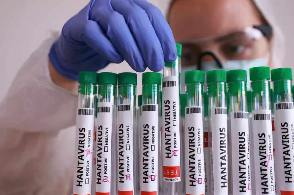 A test tube labelled "Hantavirus positive" is held in this illustration taken May 7, 2026. REUTERS/Dado Ruvic/Illustration