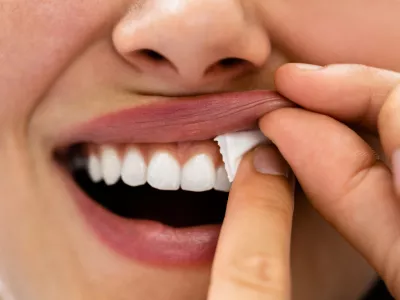 Woman Chewing Wet Moist Nicotine Tobacco Snus Product / Foto: Andreypopov Getty Images