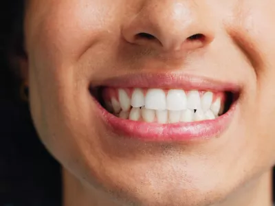 Person, teeth and mouth with smile for dental clean, hygiene or oral and gum care treatment. Closeup, lips and tooth whitening with dentist for cavity or plaque removal on a blue studio background / Foto: Jacob Wackerhausen