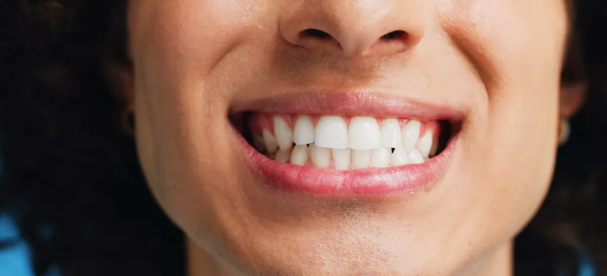 Person, teeth and mouth with smile for dental clean, hygiene or oral and gum care treatment. Closeup, lips and tooth whitening with dentist for cavity or plaque removal on a blue studio background / Foto: Jacob Wackerhausen