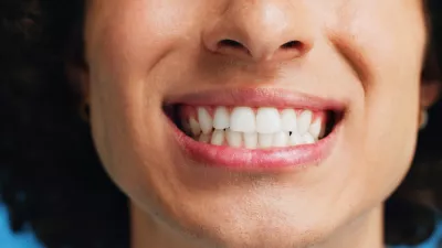 Person, teeth and mouth with smile for dental clean, hygiene or oral and gum care treatment. Closeup, lips and tooth whitening with dentist for cavity or plaque removal on a blue studio background / Foto: Jacob Wackerhausen