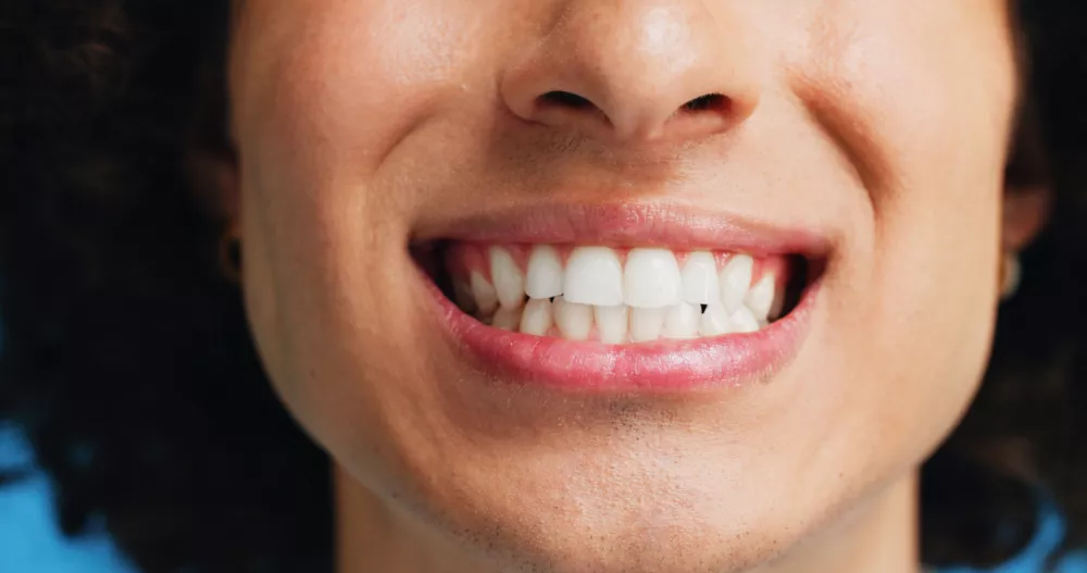 Person, teeth and mouth with smile for dental clean, hygiene or oral and gum care treatment. Closeup, lips and tooth whitening with dentist for cavity or plaque removal on a blue studio background / Foto: Jacob Wackerhausen