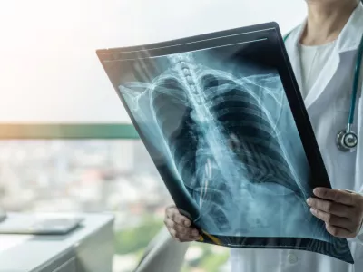 Doctor diagnosing patient&acirc;s health on asthma, lung disease, COVID-19 or bone cancer illness with radiological chest x-ray film for medical healthcare hospital service