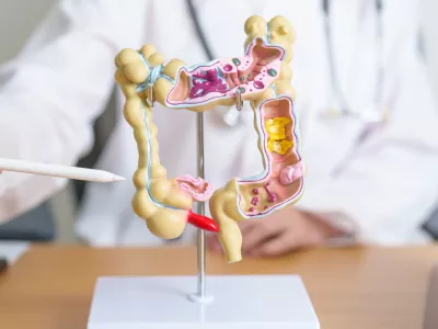 Doctor with human Colon anatomy model and tablet. Colonic disease, Large Intestine, Colorectal cancer, Ulcerative colitis, Diverticulitis, Irritable bowel syndrome and Digestive system