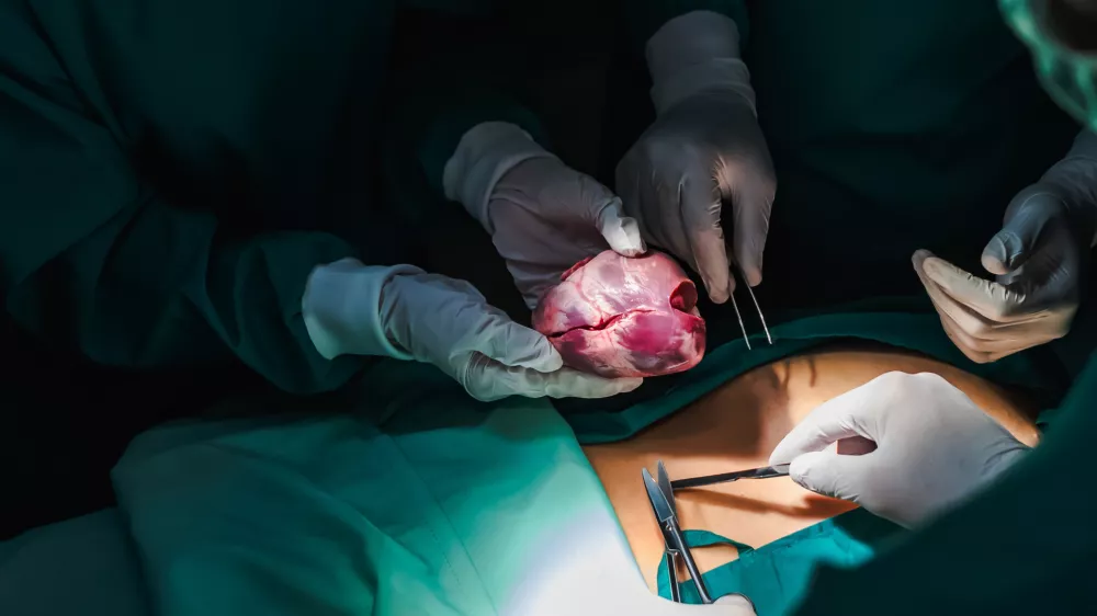 Simbolična slika operacije zamenjave srca. / Foto: Istock