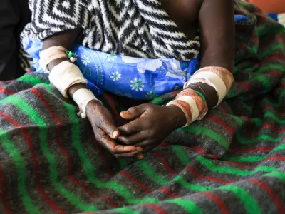 WEST POKOT, KENYA - MAY 09: The miners who were rescued injured from yesterday's mine collapse in a gold mine in the Rumos Hills are receiving treatment at Kapenguria Regional Hospital in West Pokot, Kenya on May 09, 2026. The disaster resulted in the deaths of 15 people, including 10 women, while survivors were rushed to hospital for urgent medical treatment. Lucas Mukasa / AnadoluNo Use USA No use UK No use Canada No use France No use Japan No use Italy No use Australia No use Spain No use Belgium No use Korea No use South Africa No use Hong Kong No use New Zealand No use Turkey