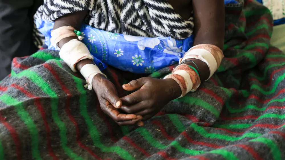 WEST POKOT, KENYA - MAY 09: The miners who were rescued injured from yesterday's mine collapse in a gold mine in the Rumos Hills are receiving treatment at Kapenguria Regional Hospital in West Pokot, Kenya on May 09, 2026. The disaster resulted in the deaths of 15 people, including 10 women, while survivors were rushed to hospital for urgent medical treatment. Lucas Mukasa / AnadoluNo Use USA No use UK No use Canada No use France No use Japan No use Italy No use Australia No use Spain No use Belgium No use Korea No use South Africa No use Hong Kong No use New Zealand No use Turkey