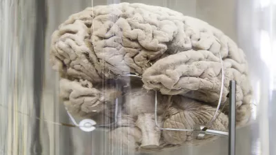 Human brain, detail of a human organ, intelligence and thought / Foto: Esebene