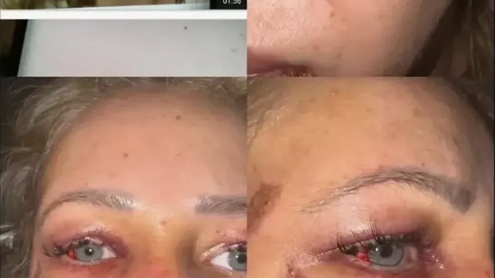 Kristina Živković je bila žrtev brutalnega napada nekdanjega partnerja. F instagram
