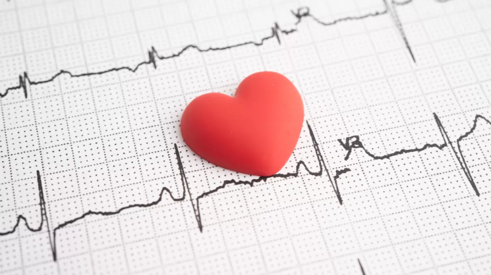 Electrocardiogram ECG heart wave, heart attack, cardiogram report. / Foto: Kanruthai Khamthet Getty Images