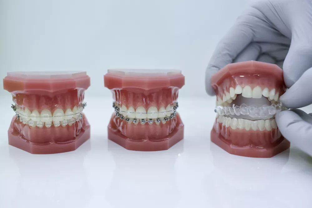 - simbolična fotografija - stomatologija - dentalna medicina - estetsko zobozdravstvo - ortodontija - ortodontski aparat za ravnanje zob - zobna proteza - zobotehnik -  //FOTO: Jaka Gasar / Foto: Jaka Gasar